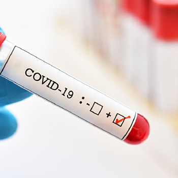 Анализ на антитела к коронавирусу