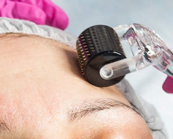 Мезотерапевтические уходы 